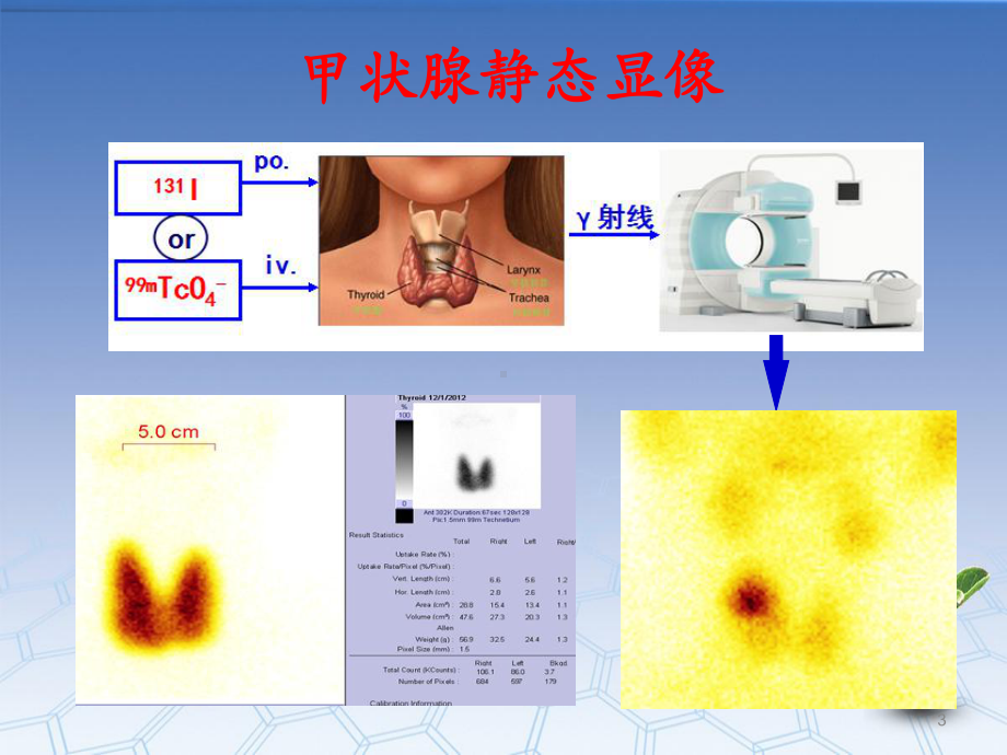 内分泌系统显像见习课件.ppt_第3页