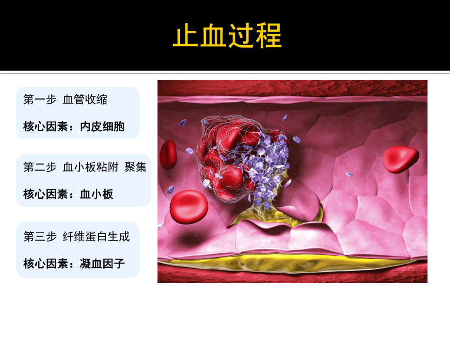 凝血机制与抗凝治疗课件.ppt_第2页