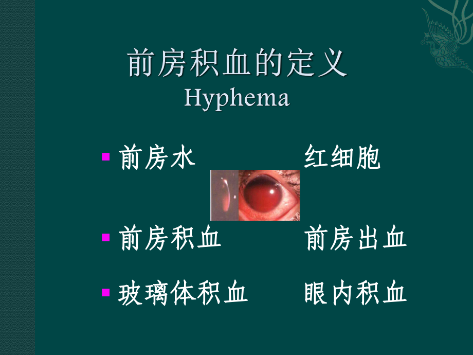 外伤性前房积血与并发症的诊治课件.ppt_第2页