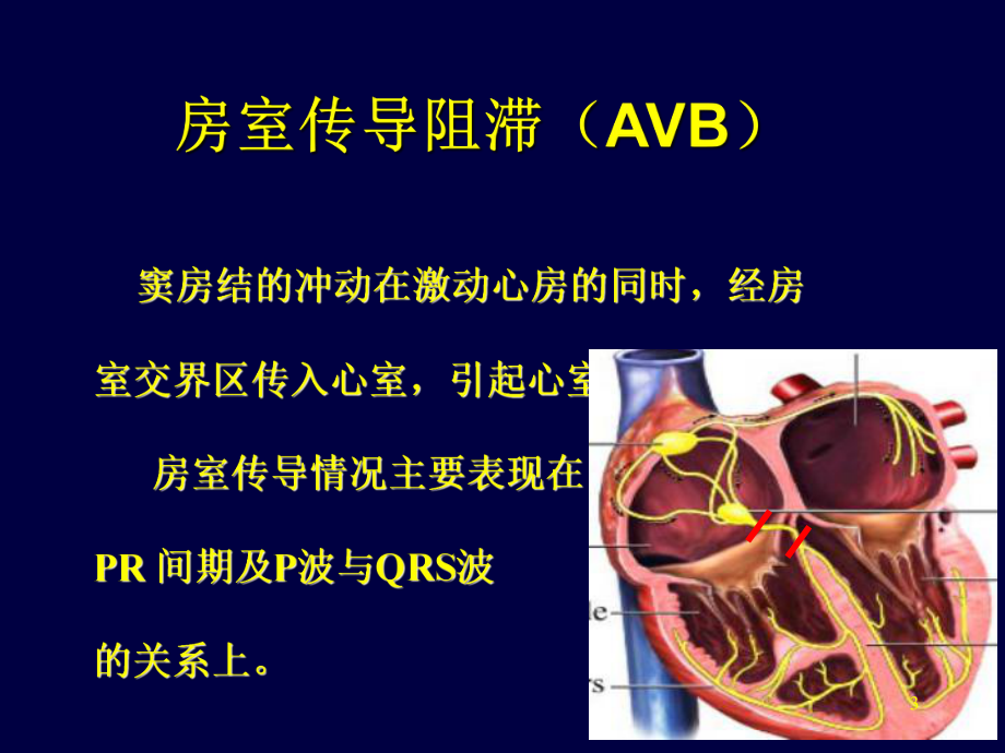 心电图知识普及讲座课件.ppt_第3页