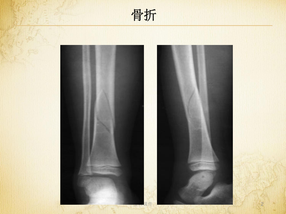 医学影像成像概论课件.ppt_第2页