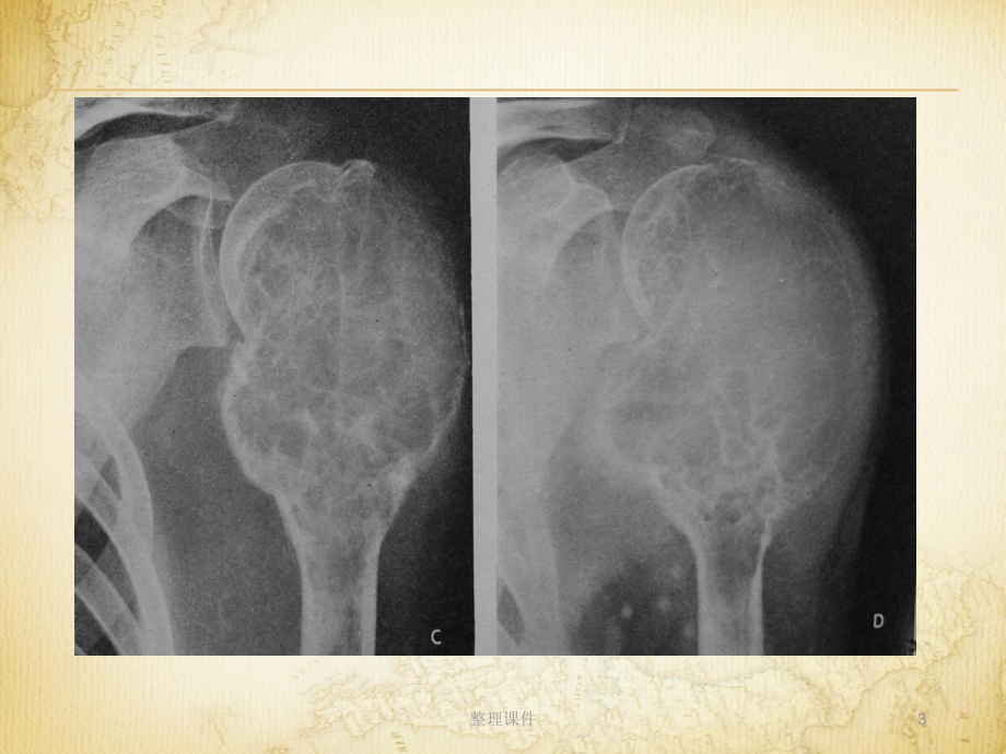 医学影像成像概论课件.ppt_第3页