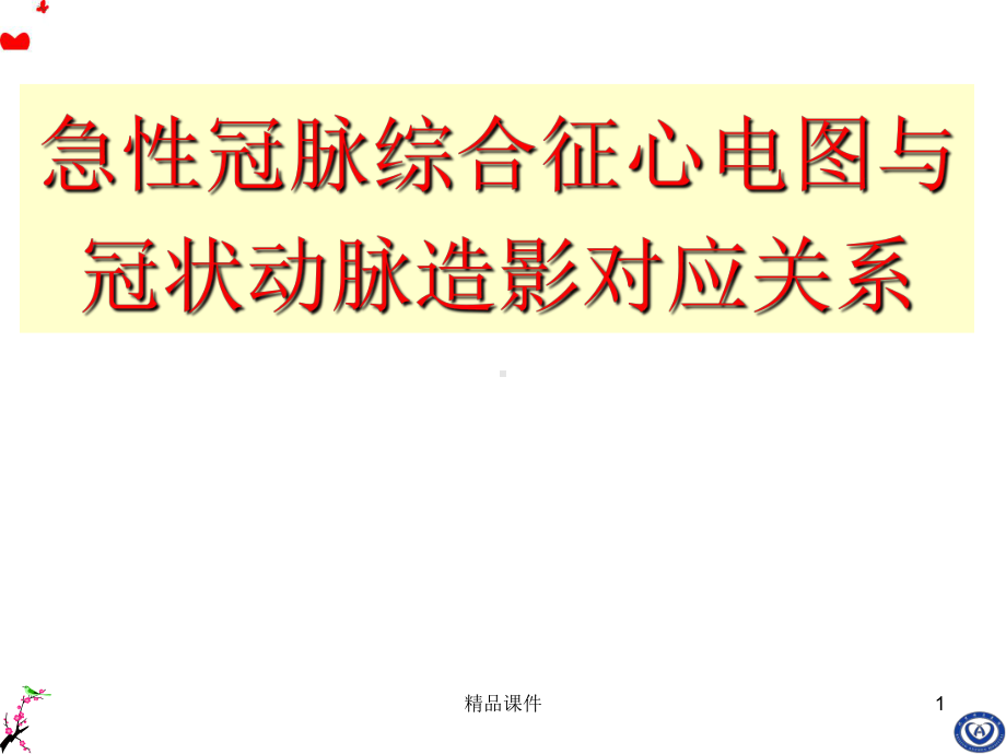 急性心肌梗死心电图与冠状动脉造影对应关系课件.ppt_第1页