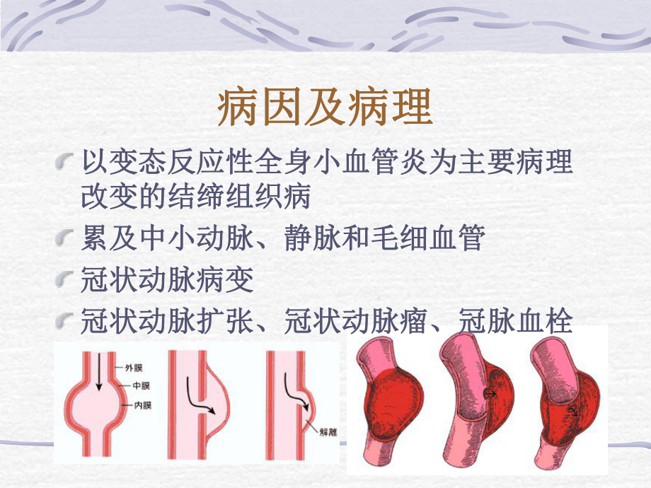 儿科护理学课件第十三章川崎病.ppt_第2页