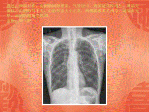 常见40张X片读片和诊断共41张课件.ppt