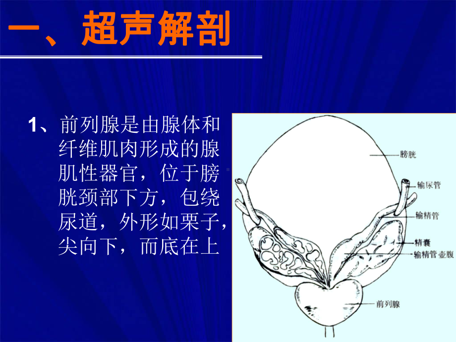 前列腺的超声探查课件.ppt_第3页