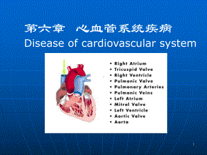 心血管疾病(动脉粥样硬化)课件.ppt