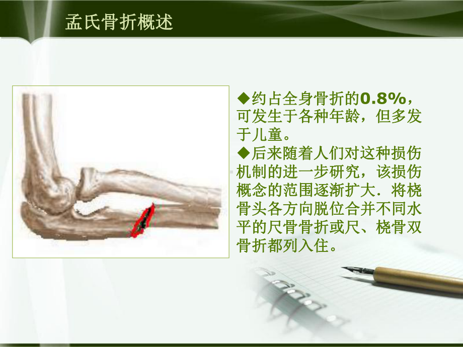 儿童孟氏骨折课件.ppt_第2页