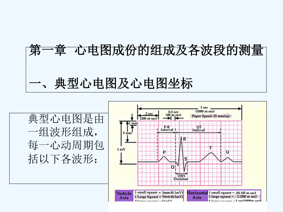 儿童心电图特点-课件.ppt_第2页