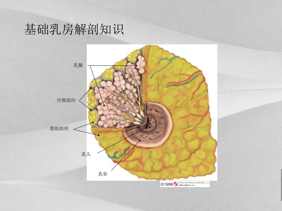 微创乳腺活检技术研讨课件.ppt_第2页