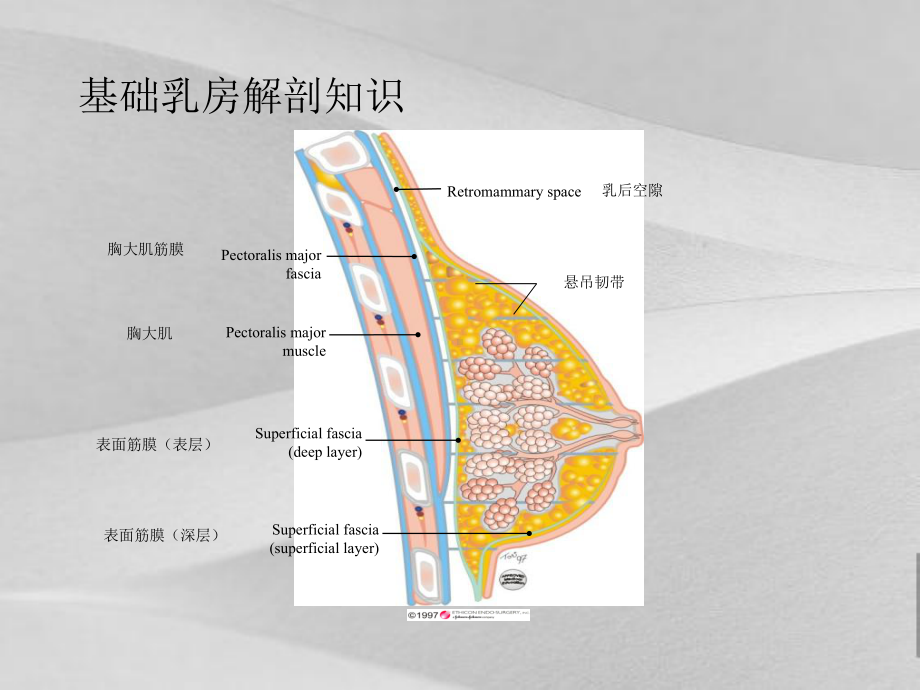 微创乳腺活检技术研讨课件.ppt_第3页