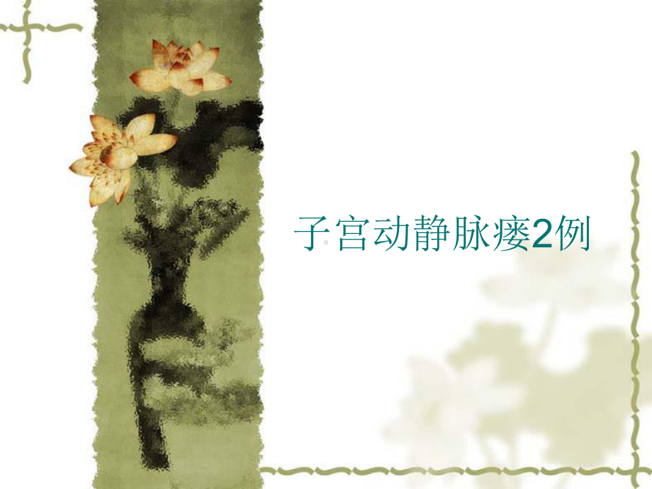 子宫动静脉瘘2例课件.ppt_第2页