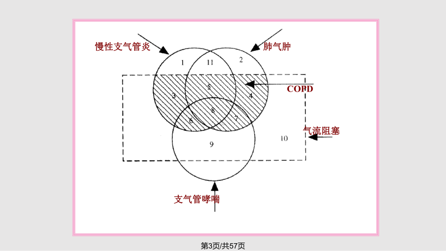 呼吸系统常见疾病的主要症状和体征1课件.pptx_第3页