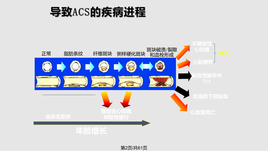 急性冠脉综合征诊治质量控制标准急性心肌梗死诊治疗解读教案课件.pptx_第3页