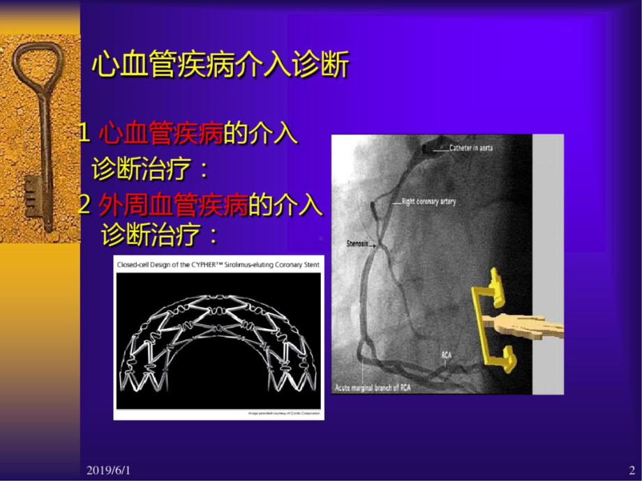 心血管疾病介入诊断治疗护理-课件.ppt_第2页