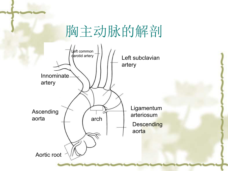 大血管病临床诊疗课件.ppt_第2页