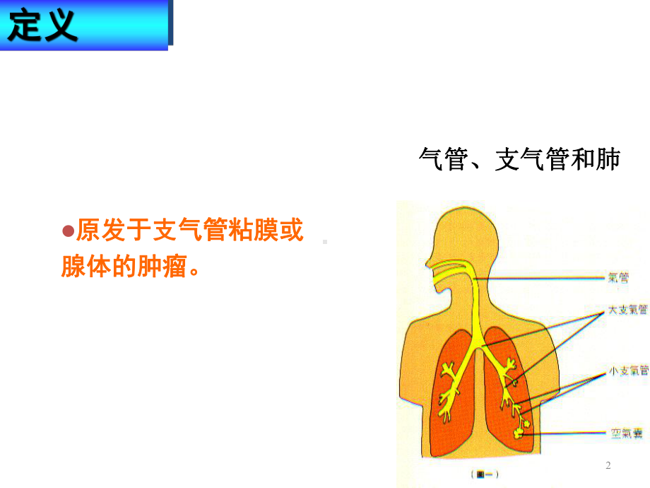 原发性支气管肺癌治疗课件.ppt_第2页