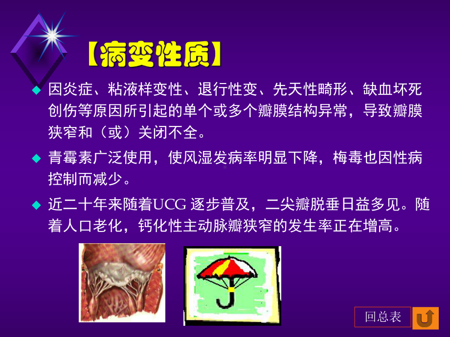 华西心脏瓣膜病课件.ppt_第2页