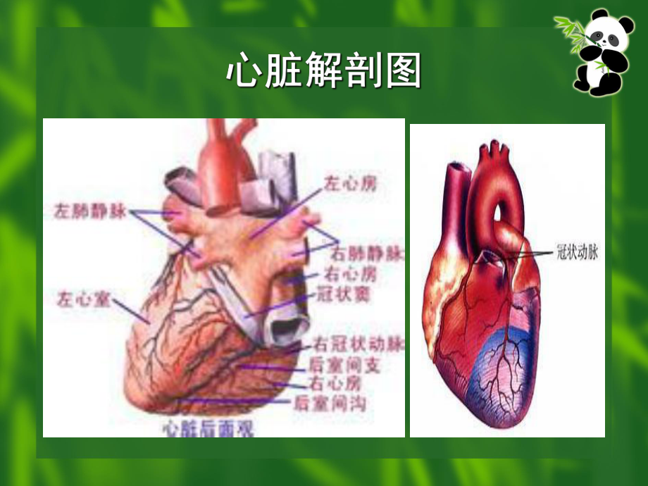 冠心病的护理解答课件.ppt_第3页