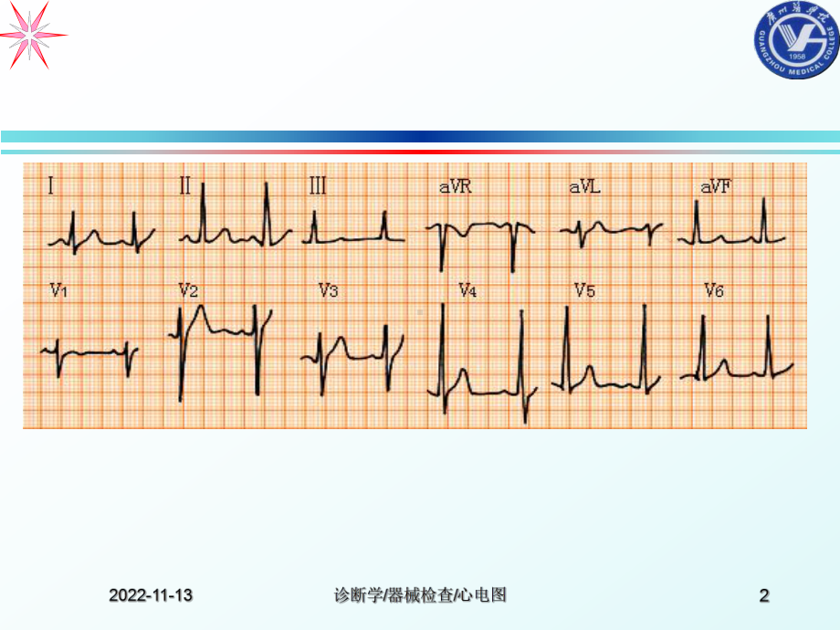 心电图完美课件课件.ppt_第2页