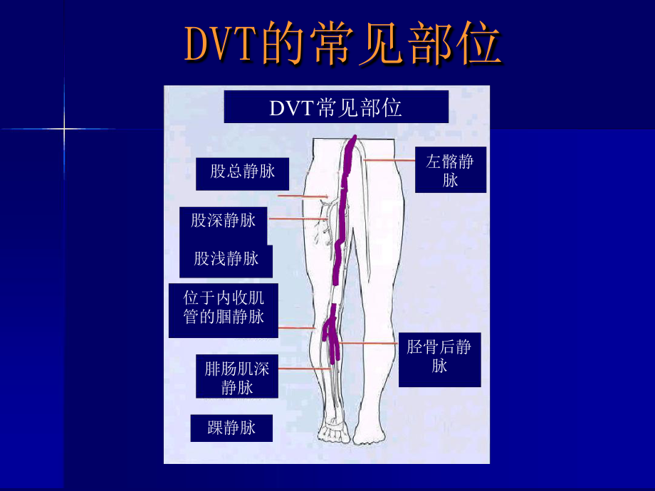 围术期静脉血栓和肺栓塞-课件.ppt_第3页