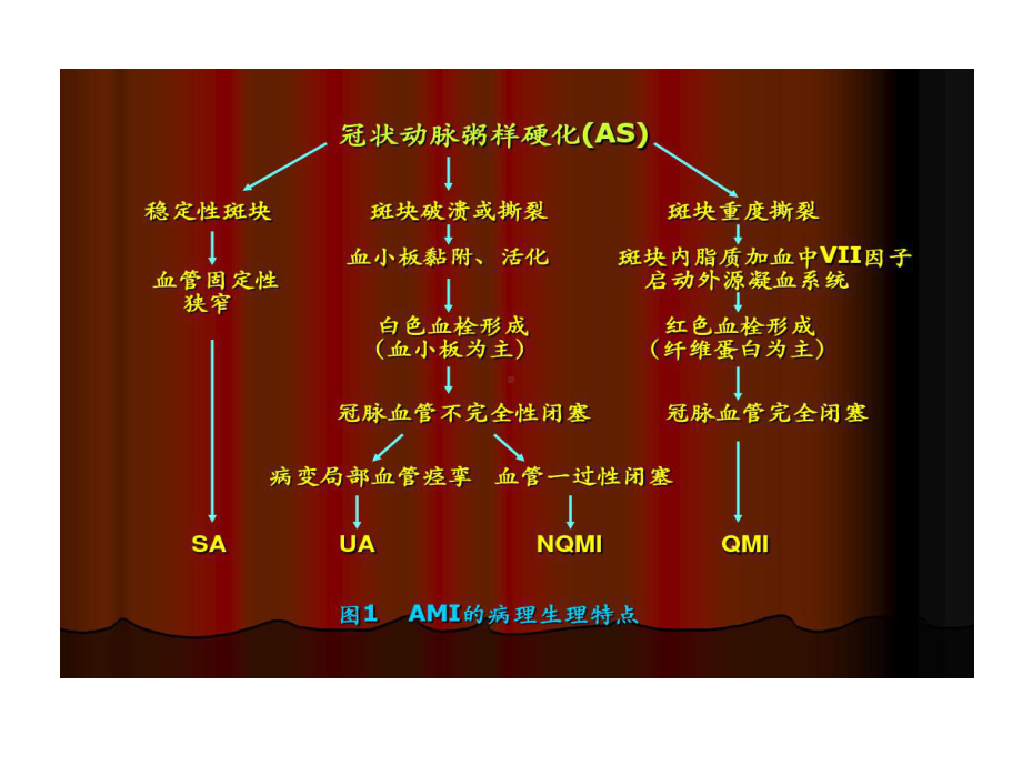 急性心肌梗死诊断与治疗共68张课件.ppt_第3页