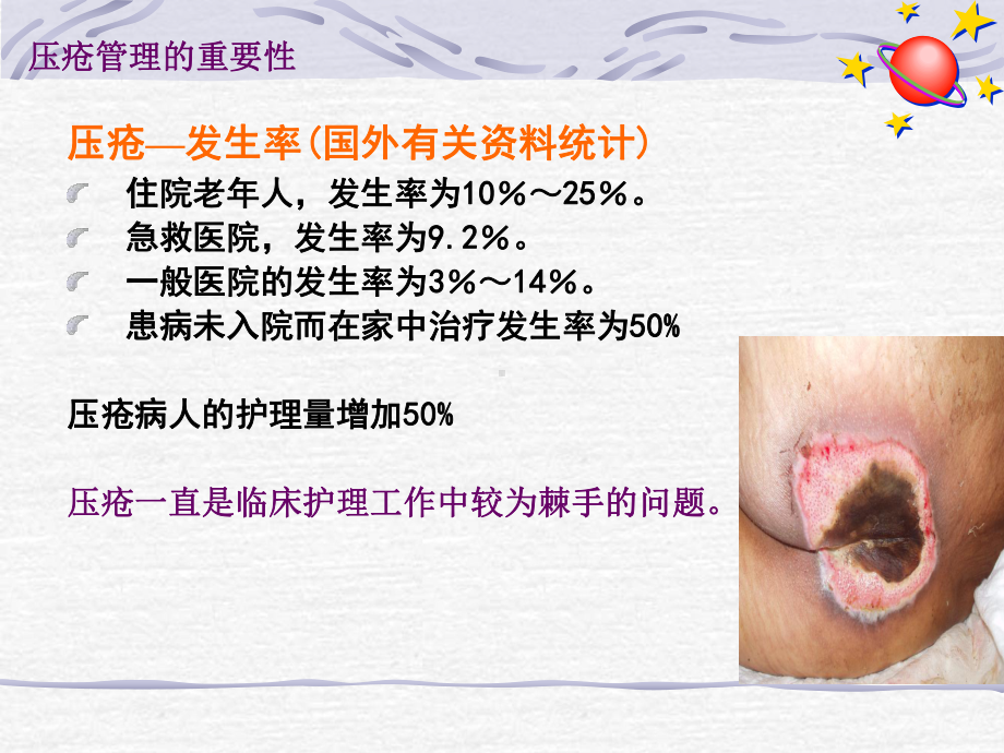 压疮风险管理课件.ppt_第2页