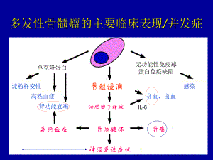 多发性骨髓瘤的分层治疗70张课件.ppt