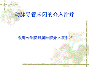 动脉导管未闭的介入治疗课件.ppt