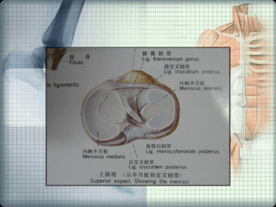 半月板损伤的磁共振表现课件.ppt_第2页