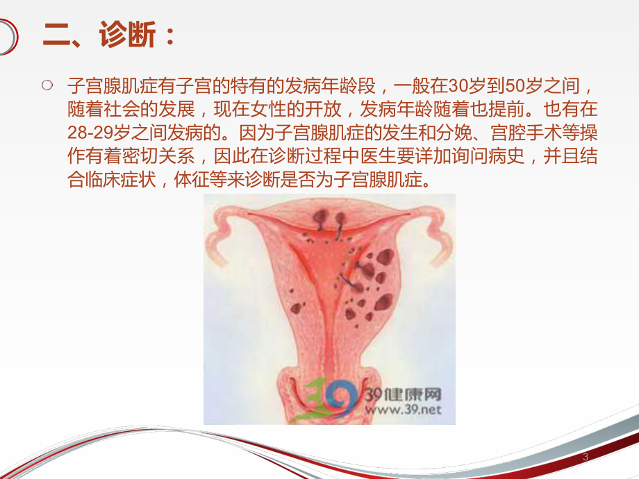 子宫腺肌症综述课件.ppt_第3页