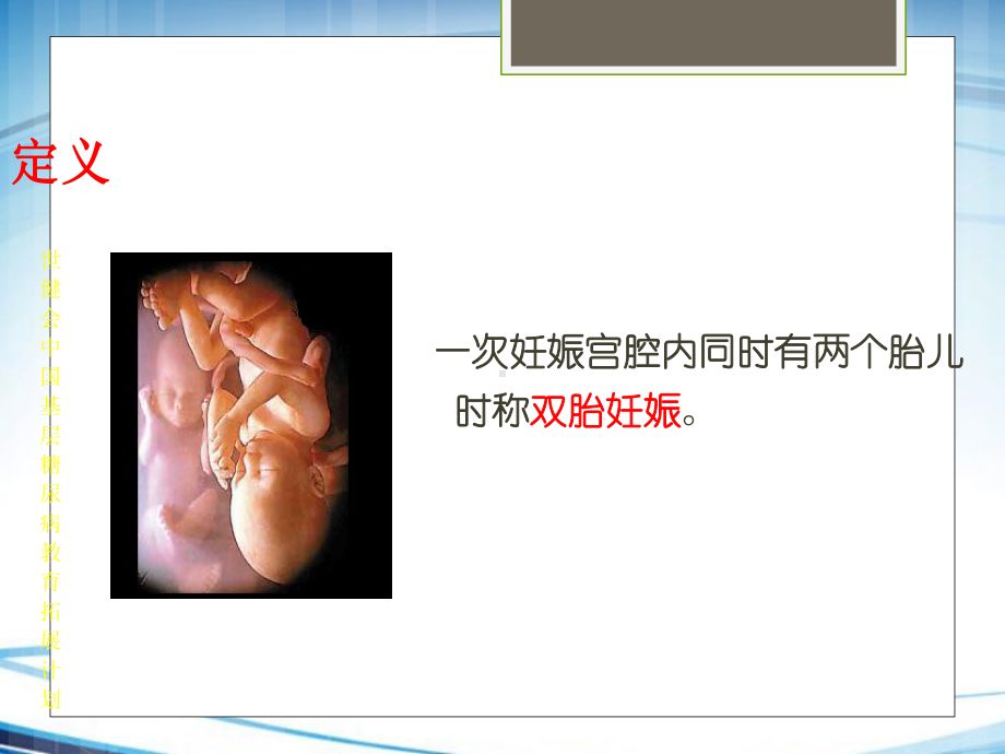 双胎妊娠课件.ppt_第2页