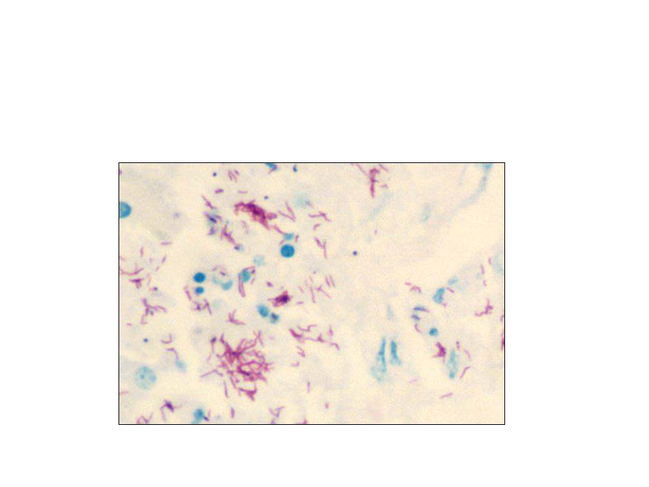 医学微生物学课件第11章分枝杆菌属.ppt_第3页