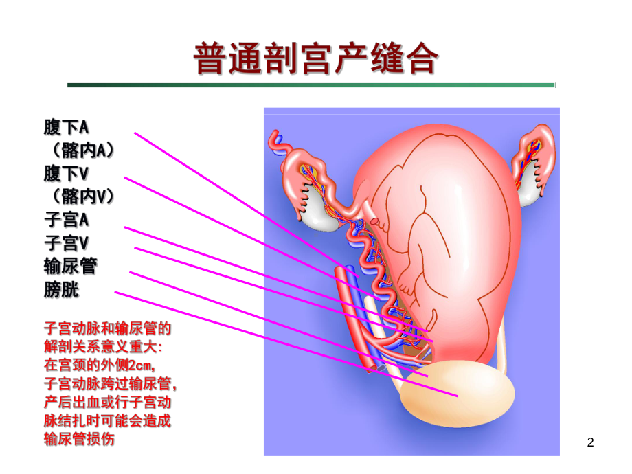 剖宫产手术缝合技术课件-2.ppt_第2页