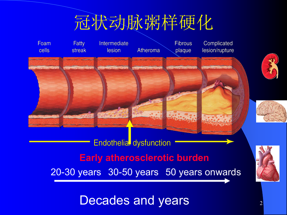 冠状动脉介入治疗进展课件.ppt_第2页