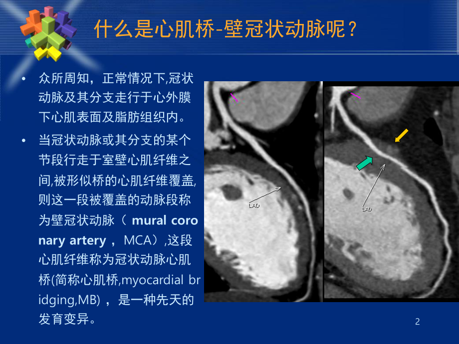 心肌桥(课堂)课件.ppt_第2页