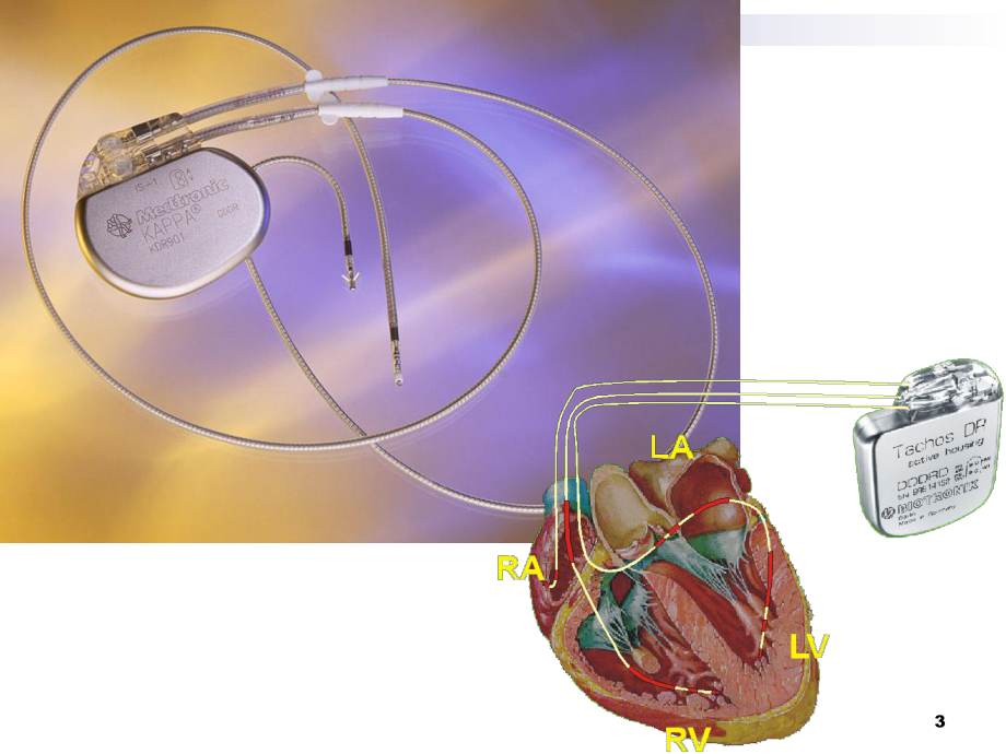 心脏起搏器护理查房课件-2.ppt_第3页