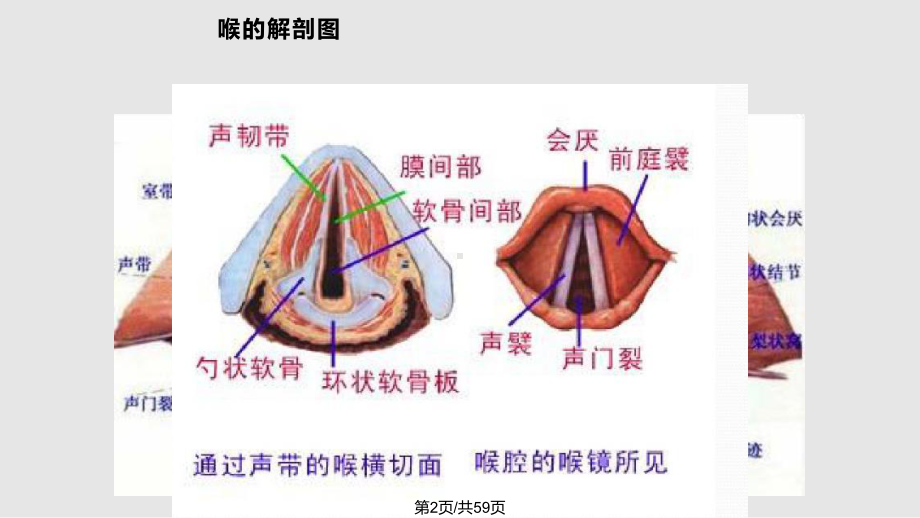 喉痉挛的处理课件.pptx_第2页