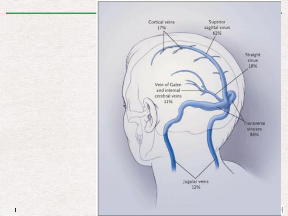 大脑静脉系统解剖课件.ppt_第3页
