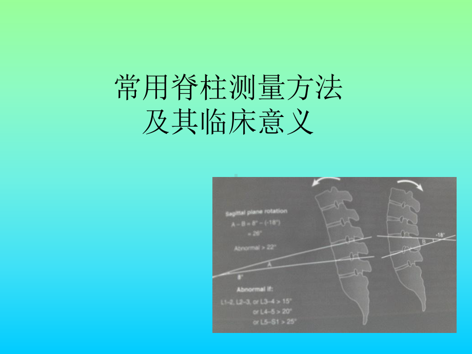 常用脊柱测量方法及其临床意义医学课件.ppt_第1页