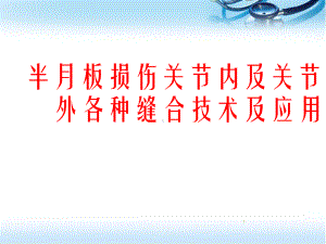 半月板缝合课件.ppt