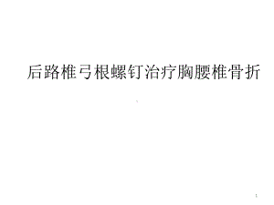 后路椎弓根螺钉治疗胸腰椎骨折课件.ppt