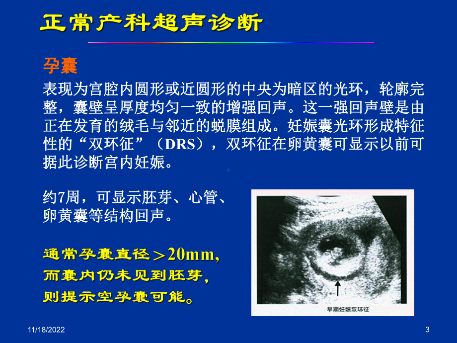 妇产科超声检查完整版24张课件.ppt_第3页