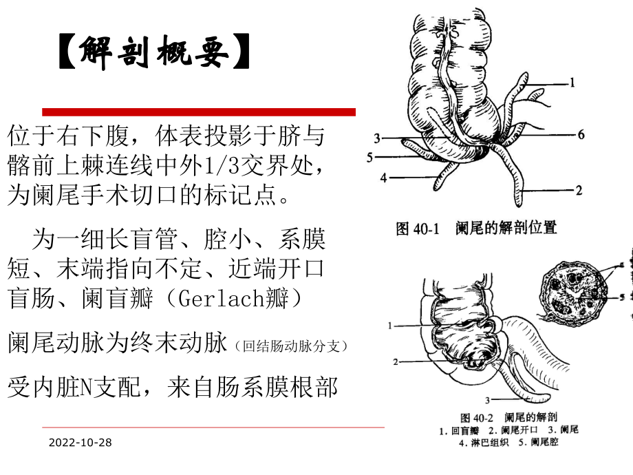 急性阑尾炎及护理-课件.pptx_第3页