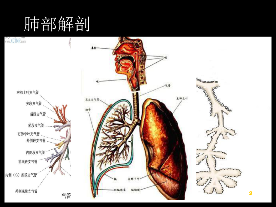 慢性支气管炎肺炎等修改课件.ppt_第2页