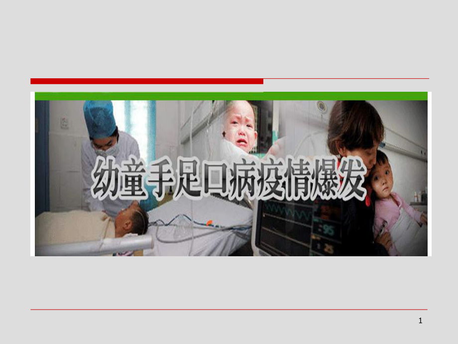 手足口病神经系表现课件.ppt_第1页