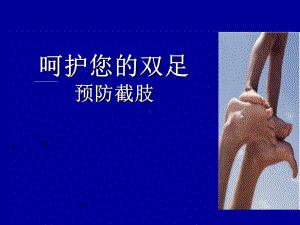 患者教育糖尿病足课件.ppt