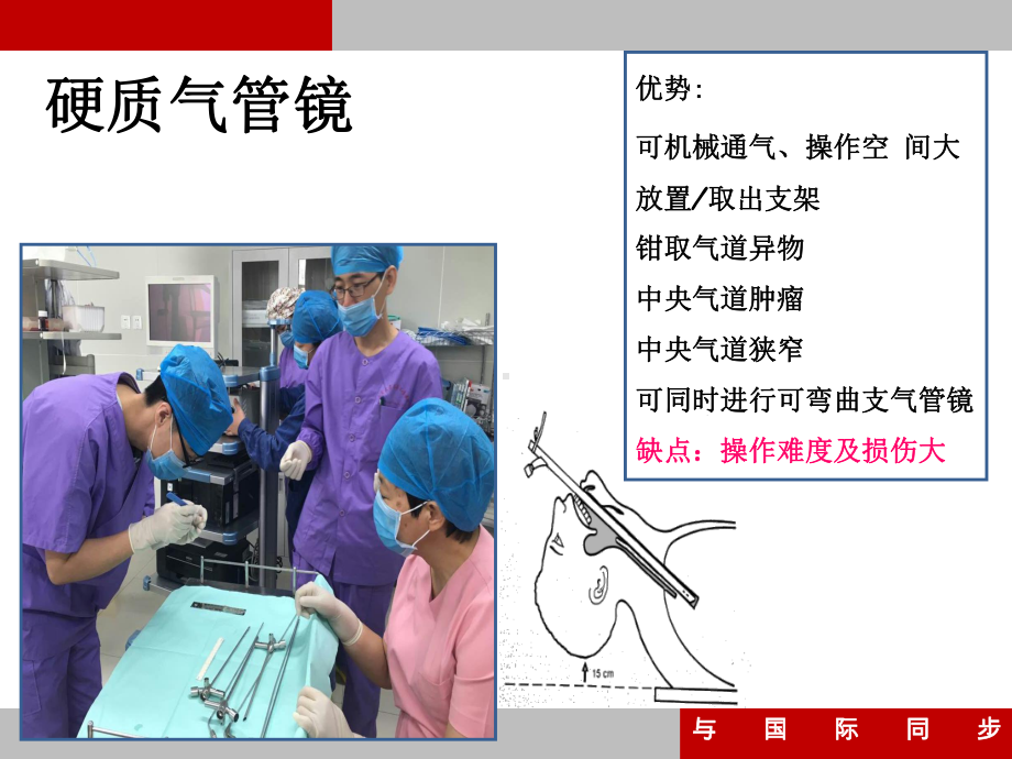 支气管镜培训课件.pptx_第3页