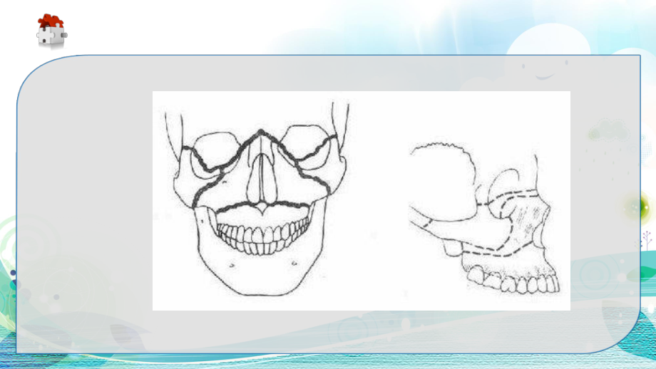 教学--颌骨骨折护理课件.ppt_第3页