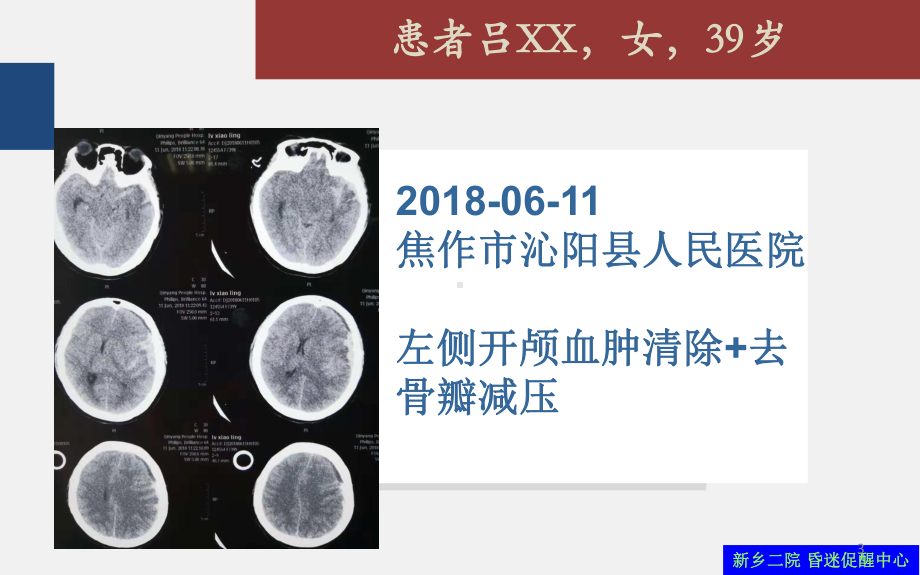 昏迷促醒案例分享及治疗策略课件.ppt_第3页